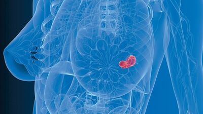 Kansere rağmen mesaiye devam