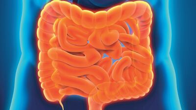 Kolon kanserinden korunmak için bunlara dikkat edin!