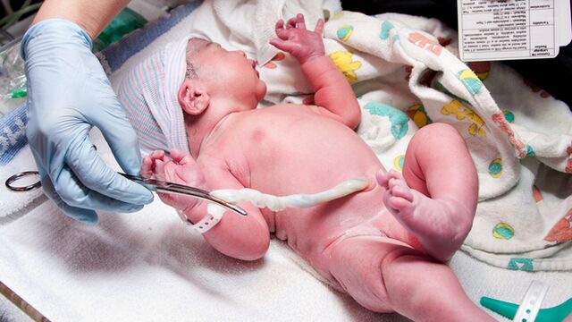 Göbek kordonu hemen kesilmeli mi?