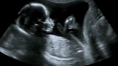 Bugün itibari ile çocuk isteğimiz artacak çünkü...