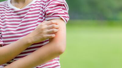 Sivrisineklere karşı doğal çözüm!