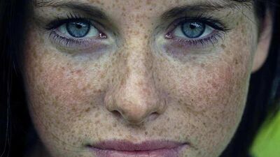 Çillerinizi yoğurtla yok edin