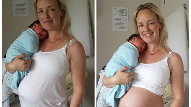 Doğum sonrası göbeğinizden korkmayın!