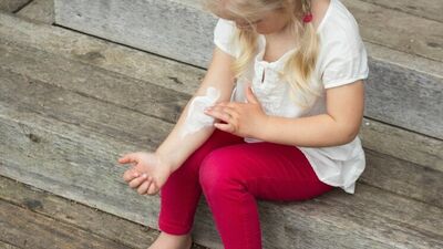 Çocuklarda sinek ve böcek sokmasına dikkat!