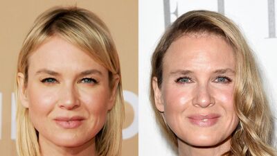 Estetik mağdurları