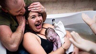 Doğumun gerçek fotoğrafları