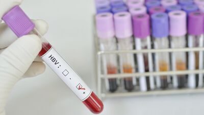 Sarılık belirtileri