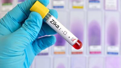 Zika virüsü korkutuyor!
