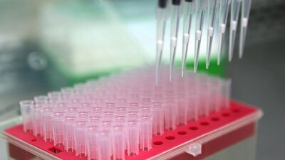 Zika aşısı 18 ay alabilir