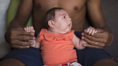 Zika virüsü rehberi