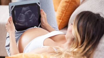 Burcu'nun gebelik günlüğü - 10. hafta