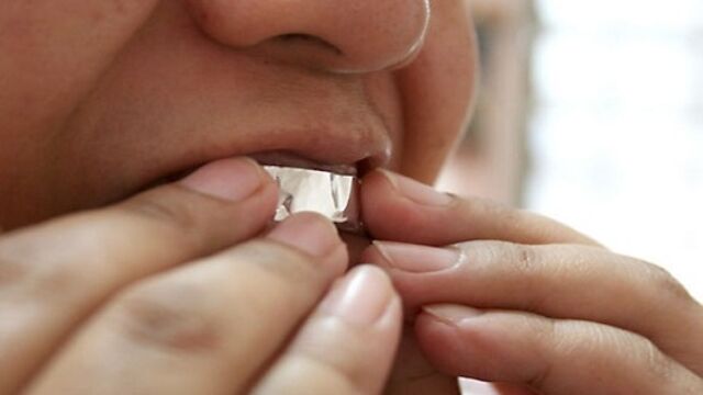 Dişlerinizi alüminyum folyo ile kaplayınca...