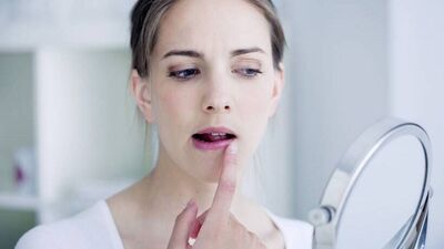 Hamilelikte uçuklara dikkat