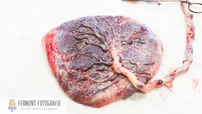 Bebeğin eşi, yaşamın kaynağı