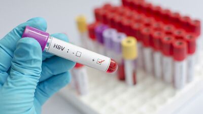 Bugün Dünya Hepatit Günü!