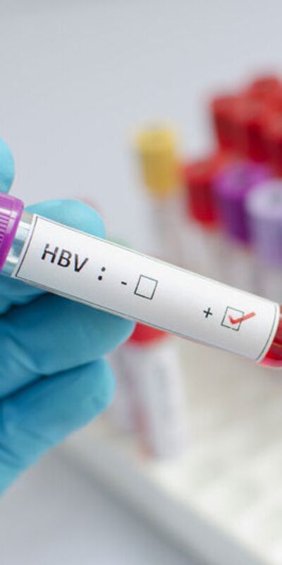 Bugün Dünya Hepatit Günü!