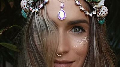 Alnındaki yara izini kapatmak için taç tasarladı