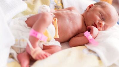 Her yıl 150 bin prematüre bebek doğuyor
