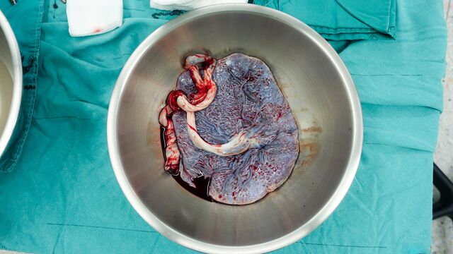 Plasentayı ne yapmalı?