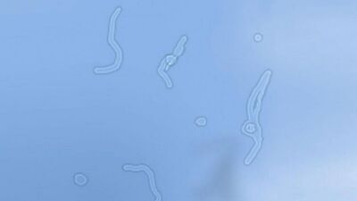 Siz de bunları görüyor musunuz?