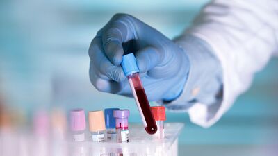 PRP hakkında neler biliyorsunuz?