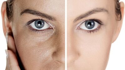 Muz kabuğuyla gözenekleri sıkılaştırın!