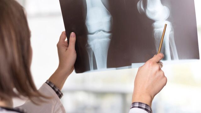 Kemik sağlığını korumanın yolları