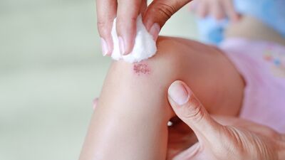 Yara iyileşmesini önleyen 4 kritik hata