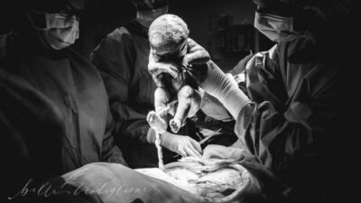 Nazik bir sezaryen öyküsü