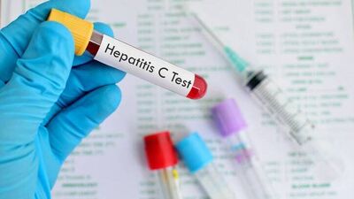 Güzelleşelim derken hepatit C kapmayın!