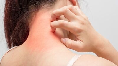 Alerjinin en etkili ilacı...