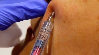 Işık dolgusu nedir?