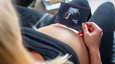 Bebeğin cinsiyeti ne zaman öğrenilir?