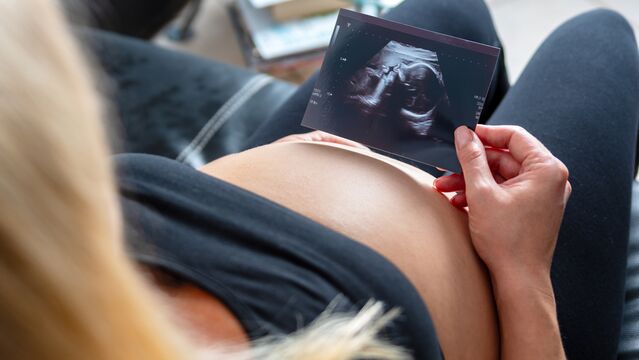 Bebeğin cinsiyeti ne zaman öğrenilir?