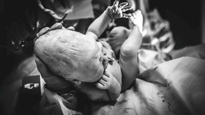 Kafasının şekli herkesi şaşırttı!