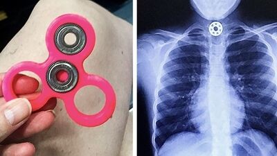 Çocuklar için tehlikeli olabilecek oyuncaklar