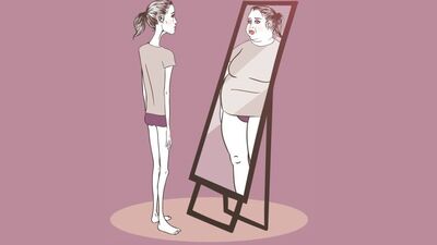 'Bir anoreksiyadan tavsiye alırsanız diye söylüyorum'