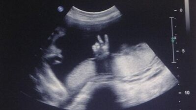 Bebekler anne karnında ne yapar?