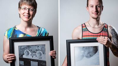 Prematüre doğanların önce ve sonrası fotoğrafları