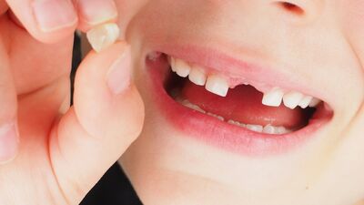 Çocuklarda diş sorunlarına ilk yardım önerileri