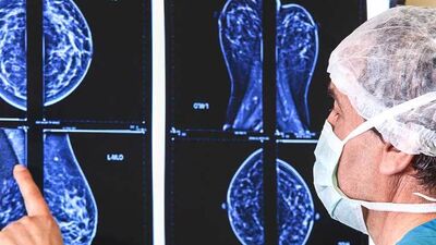 Meme kanseri taraması yaptırmaya değer mi?