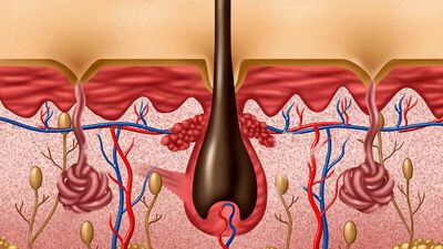 Kıl dönmesinden nasıl kurtulurum?