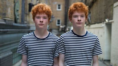 Tek yumurta ikizlerinin farklılıkları