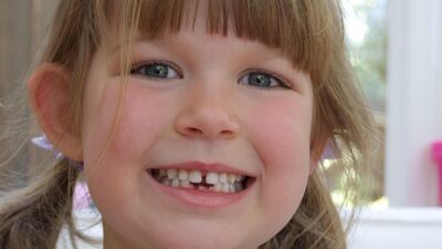 Çocukların diş problemlerinde acil müdahaleler