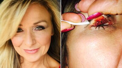 Rimelimi silmeden uyudum ve sonuç!