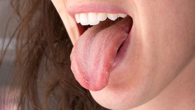 Dil kanseri hakkında bunları biliyor musunuz?