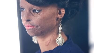 Çok güçlü bir kadın: Laxmi Agarwal