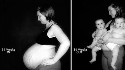 İkizlere ve tek çocuğa hamile kalmanın farkları