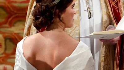 Prenses Eugenie'nin yara izi