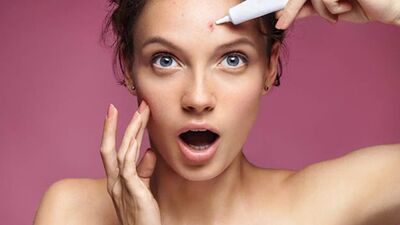 Makyajla sivilce nasıl kapatılır?